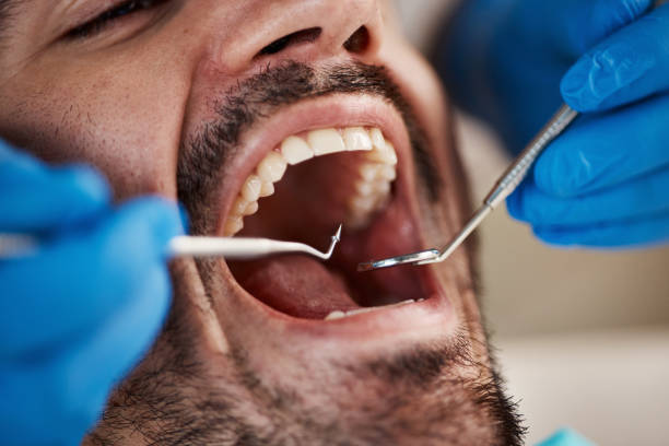 Best Emergency Broken Tooth Repair in Lexington, NC
